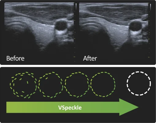 atum-medikal-vinno-handheld-ultrasound-2